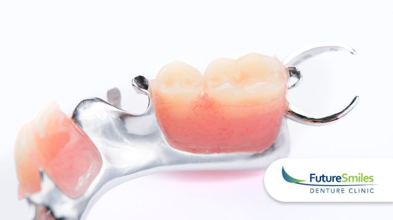 Partial Dentures vs. Dental Implants: Making the Right Choice for You